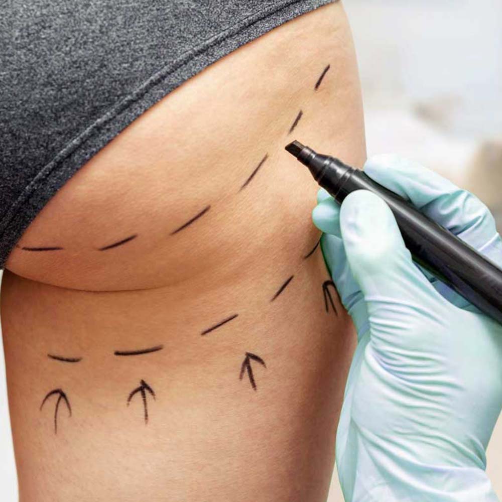 Clinic aesthetic treatment